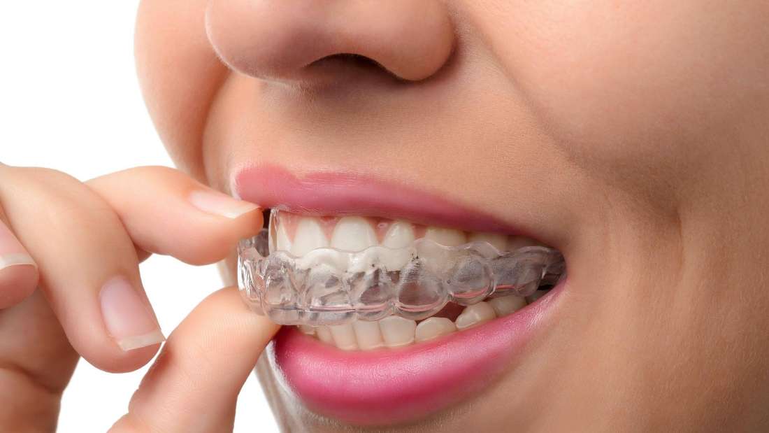 cosmetic dentist mount pleasant sc