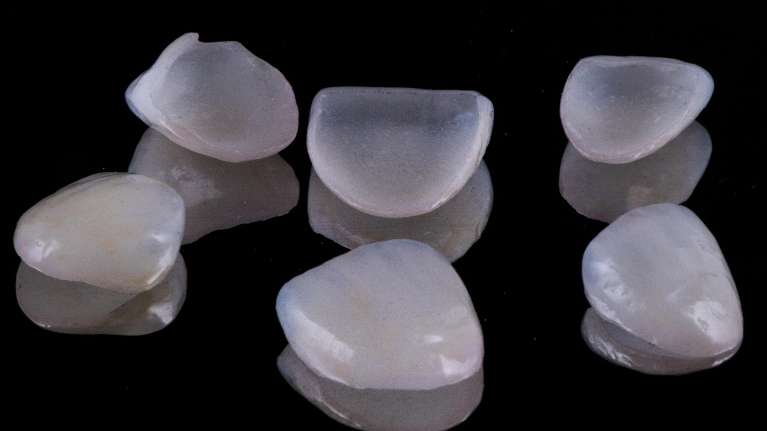 veneers in mt pleasant sc